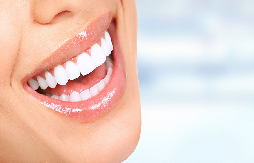 Revitalize Your Smile: Choosing the Best Dentist for a Smile Makeover