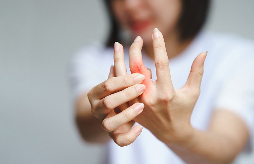 Rheumatoid Arthritis- The Causes, Symptoms And Solution