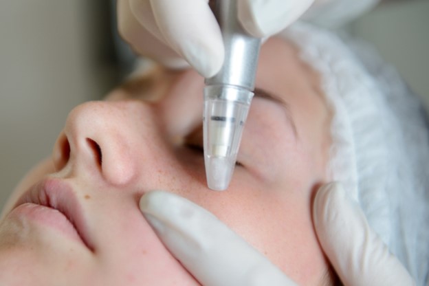 Rejuvenating Your Skin: Microdermabrasion vs. Chemical Peels