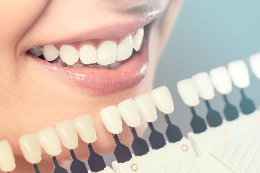 The Benefits of Taking a Professional Teeth Whitening Session in Denton, TX